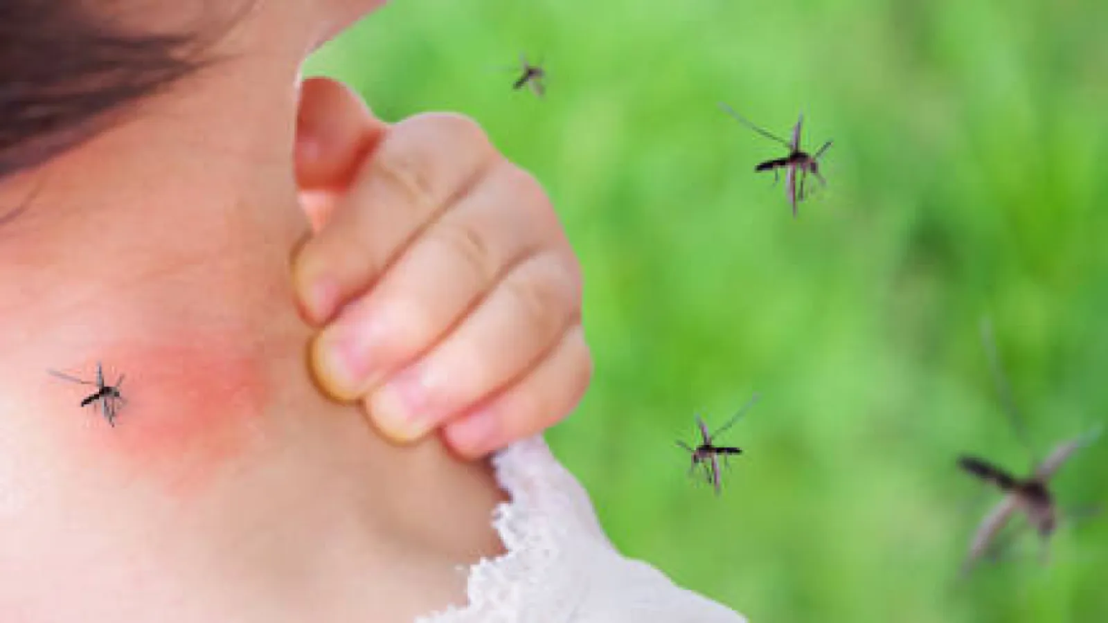 Le Chikungunia en France